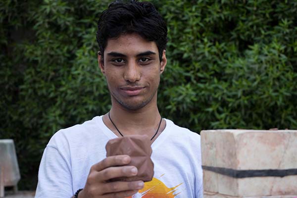 down's Syndrome picture