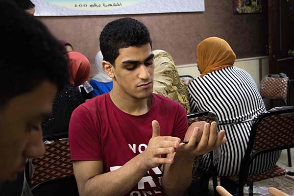 down's Syndrome picture